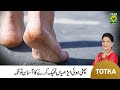 Zubaida apa totkay  how to treat cracked ankles  heels  remove quick cracked heels  ankles