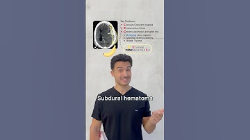 Never forget the Brain Bleeds 🧠🩸#medstudent #medschool #usmle #usmlestep1 #neurology #neuro #step1