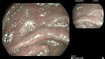 UGI - EG27-i10 & OPTIVISTA