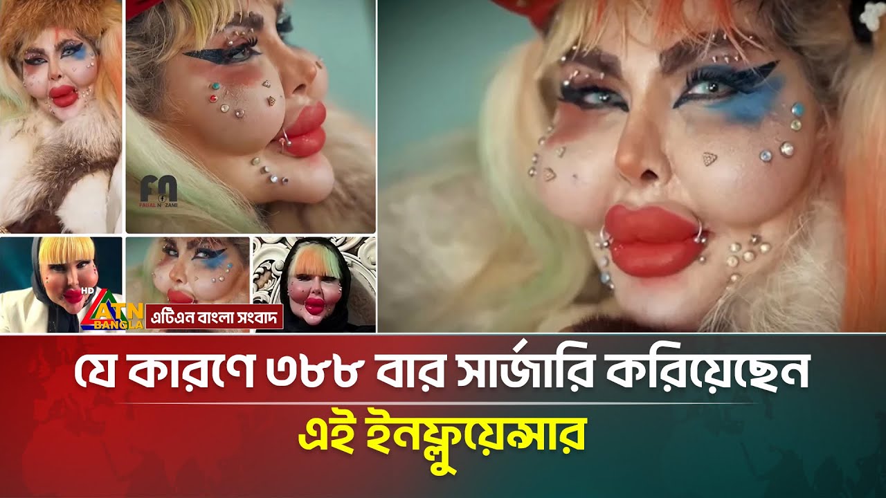৮ বছর অনাহার আর ৩৮৮ সার্জারি! রুপকথা নাকি সত্যি? | Anahita Najo | Young Girl | Iran |ATN Bangla News