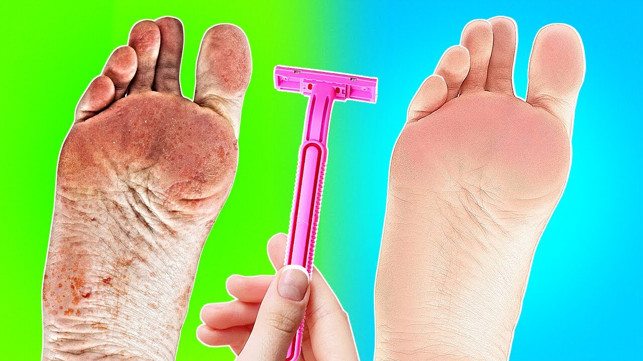 Brilliant Footcare And Shoe Hacks Your Feet Need The Most