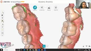 Webinar - ScanFlow - Acercamiento al entorno IOS de DEXIS