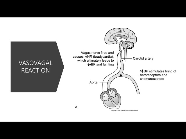 Pharmacodynamics of Radiopaque Contrast Media class=