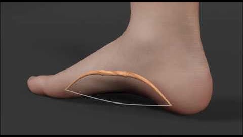 MASS Posture Orthotics:   Sports and Competetive Propulsion