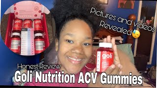 GOLI ACV GUMMIES REVIEW | WEIGHT LOSS 30+ DAYS LATER + PHOTOS