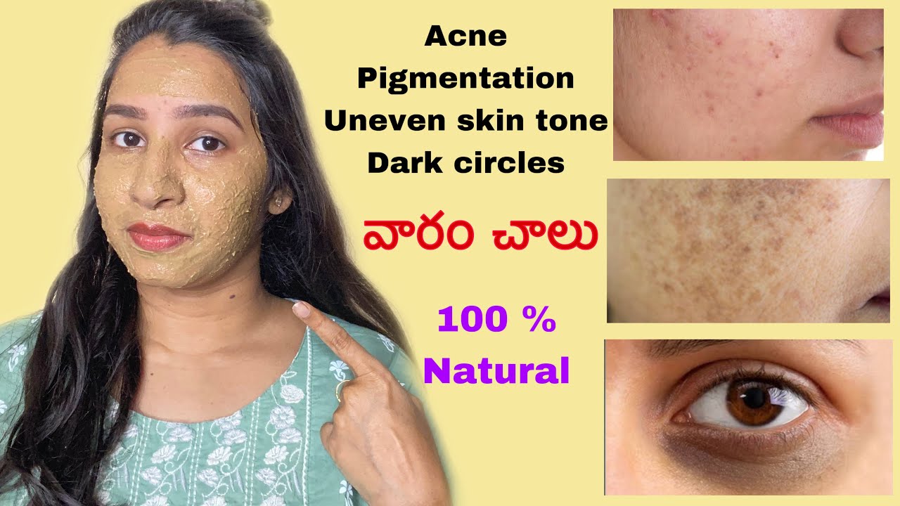 DIY face wash & face pack solution for pigmentation,dark spots,acne