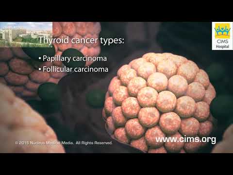 Thyroid Cancer (Gujarati) – CIMS Hospital