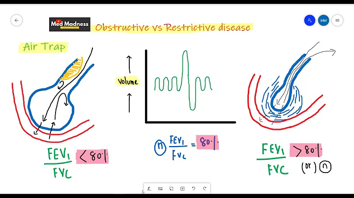 FEV1/FVC ratio in Obstructive vs Restrictive diseases | RS physiology | Med Madness