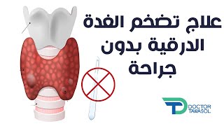 علاج تضخم الغدة الدرقية بدون جراحة