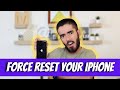 The Easiest, 10-Second Fix for your Slow iPhone!