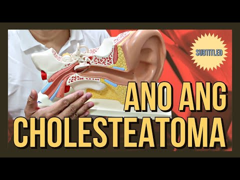 Video: Ano ang listahan ng ear entity?