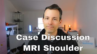 Live MRI Case Discussion - Case 4 (Shoulder)