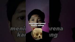 Kamu pernah melihat wujud kanker tulang? #ceritaseram