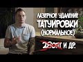 Нормальное удаление тату лазером. 28зашкварпт. Планы на канал и др.