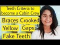 Teeth Criteria to become Cabin Crew | Braces, Crooked/ Yellow teeth, Teeth gap, Cavity, Rct