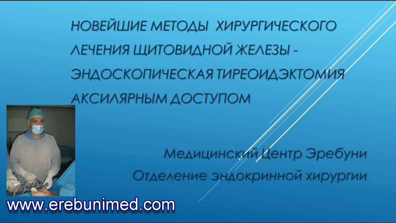 Гемитиреоидэктомия щитовидной железы что это. Трансоральная тиреоидэктомия. Гемитиреоидэктомия этапы операции. Атлас эндокринной хирургии. Тиреоидэктомия с использованием видеоэндоскопических технологий.