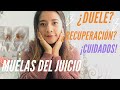 MUELAS DEL JUICIO/MI CIRUGÍA/MI EXPERIENCIA! 🤯🦷