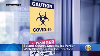 Solano County Sees Its 1st Person With COVID-19, Flu Co-Infection