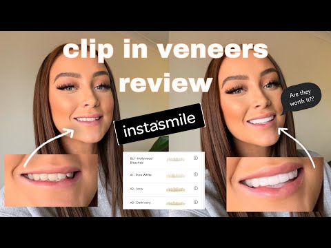 Clip In Veneers Cost Types Pros And Cons Of Clip On Veneers Clip In Veneers Cost Types Pros And Cons Of Clip On Veneers