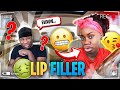 I GOT LIP "FILLERS" TO SEE HOW MY BOYFRIEND REACTS! *BOTCHED*