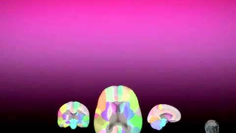 LONI Probabilistic Brain Atlas