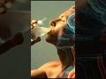 If You Cold Drink Every Day What Happens 🥤,। 3D medical animation