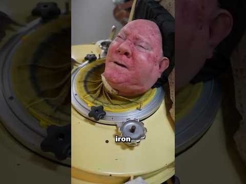 This Man Has An Iron Lung 😲 (Explained)