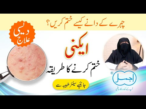 Acne Treatment Naturally in Urdu | Chehre Ke Dane Khatam Karne Ka Tarika