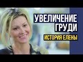 Увеличение груди | Маммопластика Киев | Отзыв пациентки