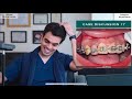 Orthobraces treatment disaster  case 17