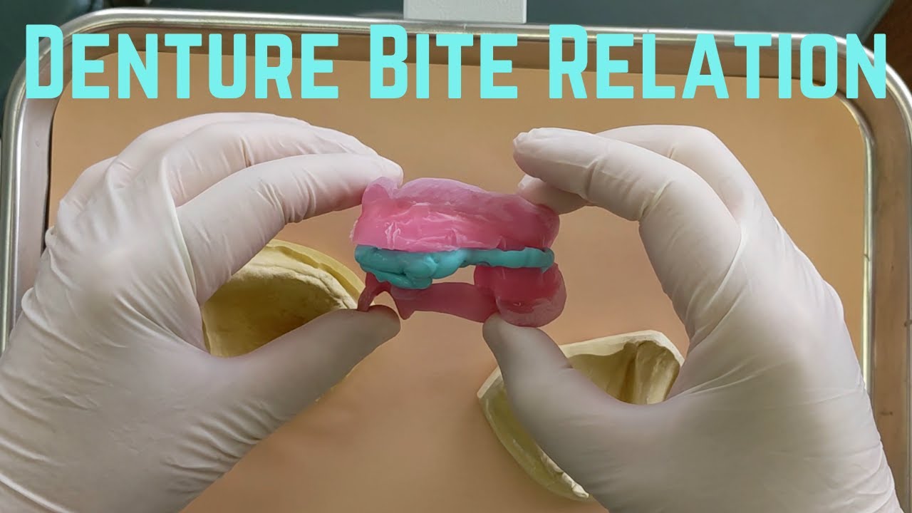 Bite Registration For A Denture YouTube bite-registration-for-a-denture-youtube