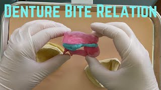 Bite Registration for a denture by Very Nice Smile Dental 29,068 views 10 months ago 9 minutes, 2 seconds