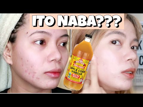 apple-cider-vinegar-toner-diy-review.-effective-ba-talaga-sya?