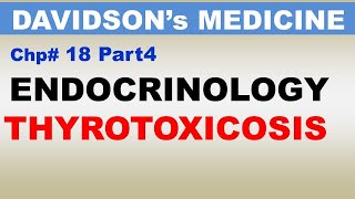 Davidson's Medicine Chp18 (Part4) | Endocrinology | THYROTOXICOSIS | Dr Asif Lectures