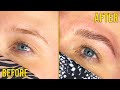 Fixing Overplucked Brows with Brow Lamination