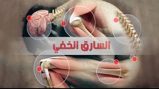 آلام  الفيبروميالجيا  ( الإلتهاب العضلي الليفي )