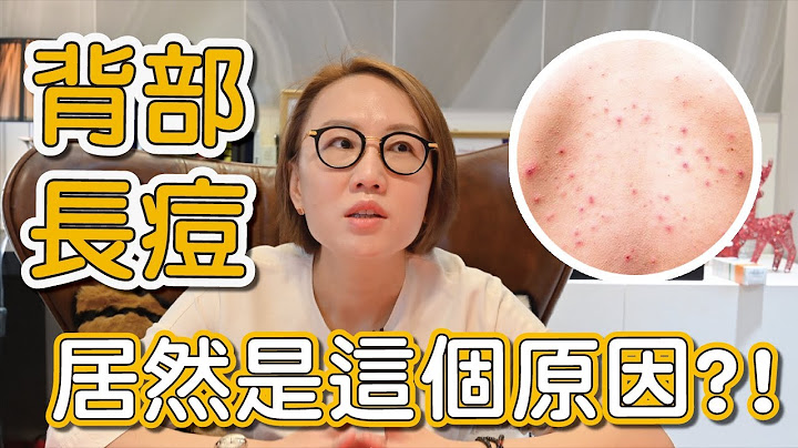 為什麼背上會長青春痘？背上的青春痘要怎麼做青春痘治療？ - 天天要聞