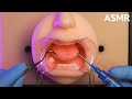 [ASMR] Rough Dentist Roleplay on Mannequin (Tonsil Stone Removal / Sub)
