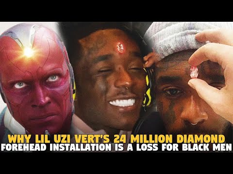 Why Lil Uzi Vert's 24 Million Diamond Forehead Installation is a LOSS FOR BLACK MEN