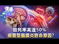 致死率高達50% 細菌行腦膜炎致命原因？【57健康同學會】20260705｜江中博、邱文瑾、許瓊月