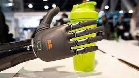 Bàn tay giả điều khiển bằng não bộ con người| VTV24