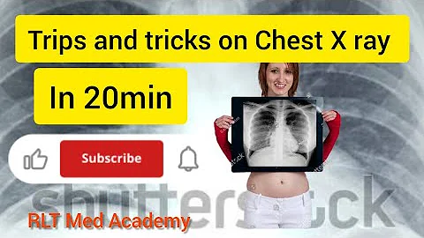 Trips and tricks to read chest x ray in 20 mins..