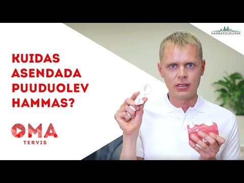 Video: Kuidas koera hambaid puhastada - ohutult!