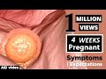 4 Weeks Pregnant Baby Position - Pregnancy Symptoms Week by Week