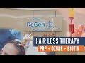 Hair loss therapy with PRP + Ozone + Biotin [English Subtitles]