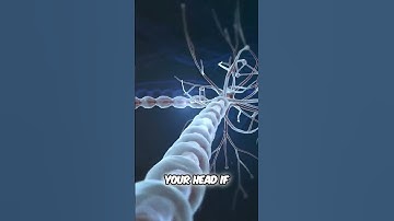 Neuralink: Brain-Computer Interface Explained. First Human Implant! #shorts