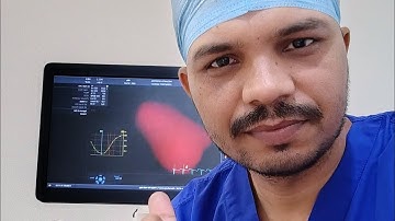 4D Echocardiography👉How to measure  4D volumes with auto LVQ 🫀