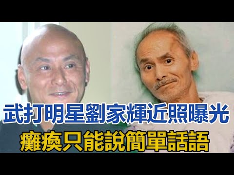 武打明星劉家輝近照曝光，癱瘓只能說簡單話語，瘦到完全認不出｜你好！八卦｜