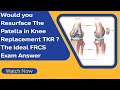 Would you Resurface The Patella in Knee Replacement TKR ? The Ideal FRCS Exam Answer