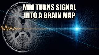 How Does an MRI Make an Image Spatial Encoding and K-Space